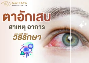 ตาอักเสบ