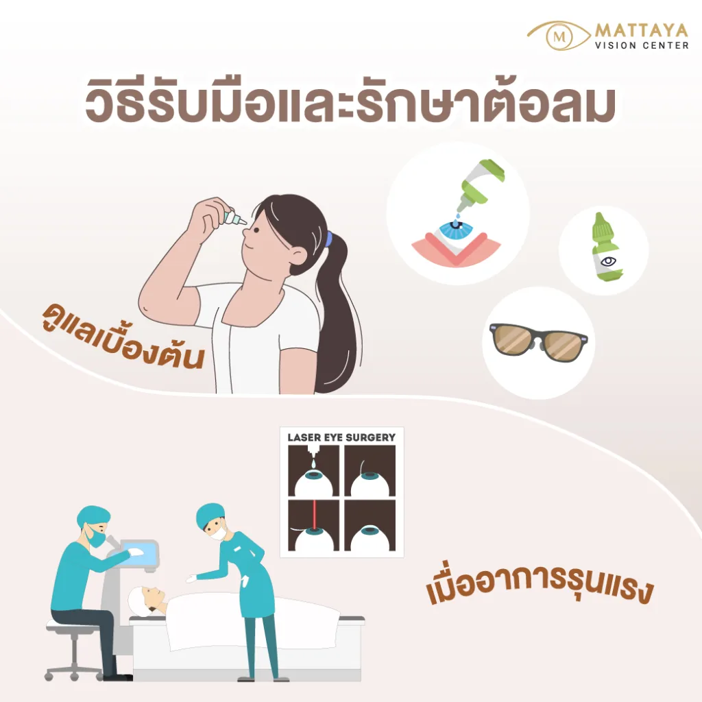 แนวทางการรักษาต้อลม