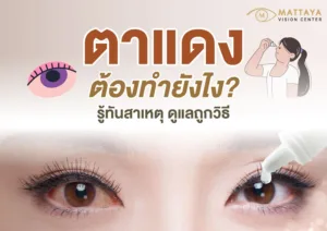 ตาแดงต้องทำยังไง? วิธีดูแลและรักษาอย่างถูกต้อง