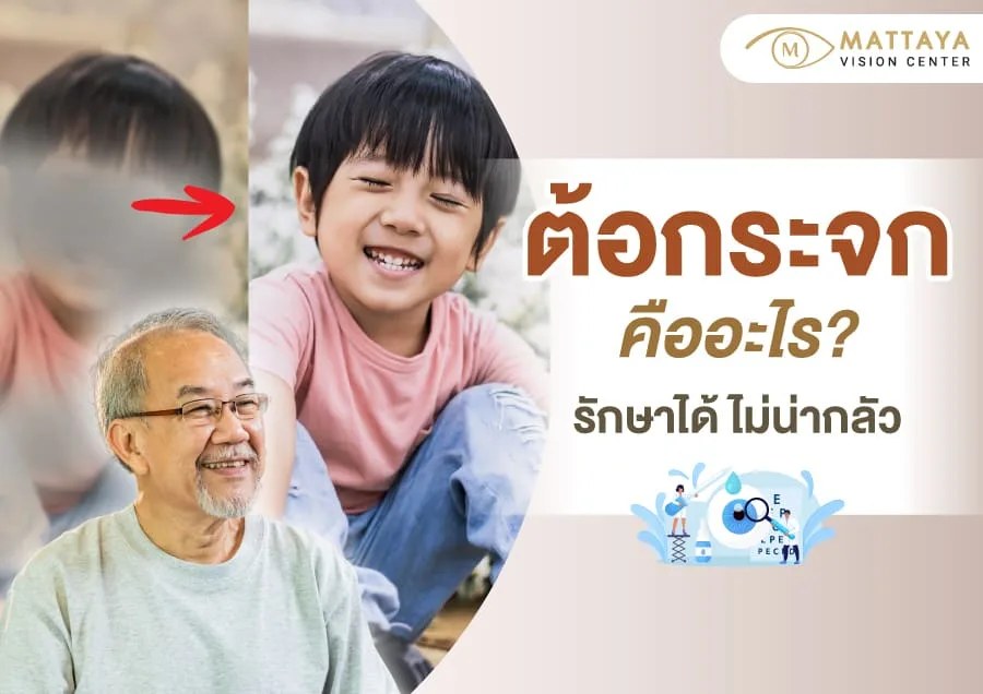 ต้อกระจก อาการเป็นอย่างไร?