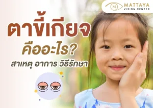 ตาขี้เกียจ คืออะไร?