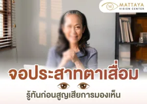 จอประสาทตาเสื่อม เข้าใจอาการ สาเหตุ และวิธีการดูแลจากแพทย์ผู้เชี่ยวชาญ